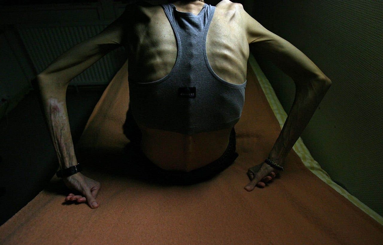 Tout savoir sur la carence en vitamine C.